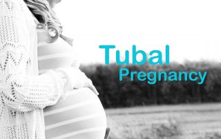 Tubal pregnancy